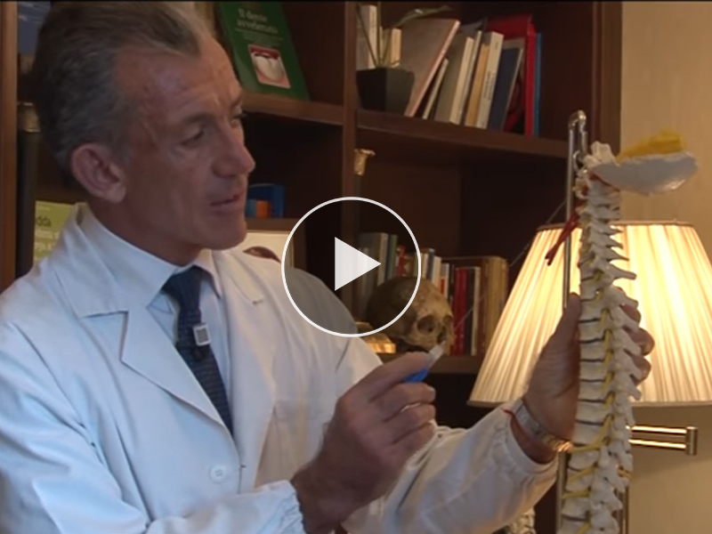 La Sindrome vertebro basilare