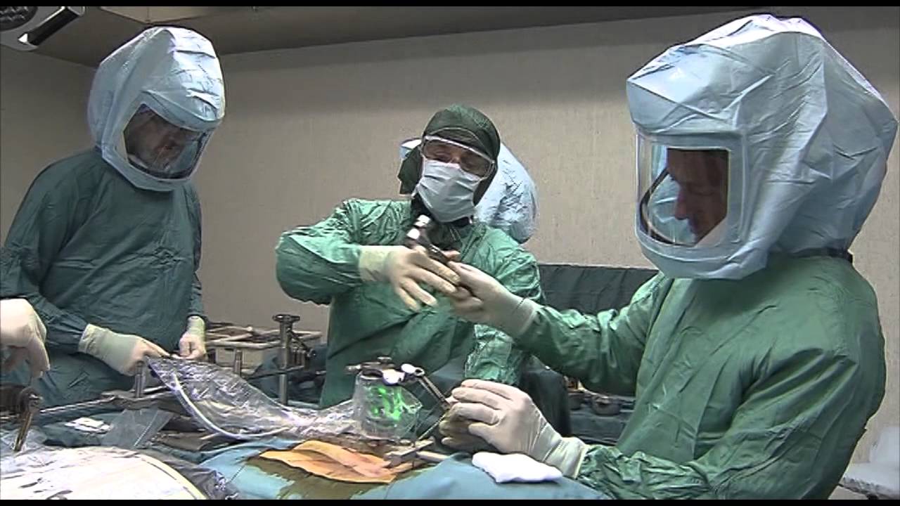 First operation Mazor Robotic - II - Schiena TV